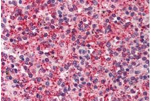 Human Spleen (formalin-fixed, paraffin-embedded) stained with KIAA1303 antibody ABIN214505 at 2. (Raptor anticorps)