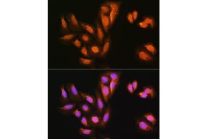 Immunofluorescence analysis of U2OS cells using KIF Rabbit pAb (ABIN1680591, ABIN3019005, ABIN3019006 and ABIN6220670) at dilution of 1:100.