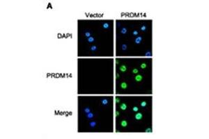 IFanalysis of PRDM14 in breast cancer cells. (PRDM14 anticorps  (N-Term))