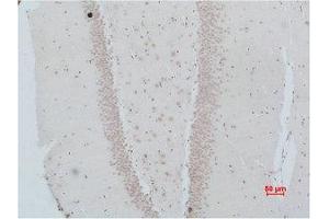 Immunohistochemistry (IHC) analysis of paraffin-embedded Rat Brain Tissue using NMBR Polyclonal Antibody. (NMBR anticorps)