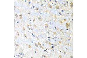 Immunohistochemistry of paraffin-embedded mouse brain using MLN antibody at dilution of 1:100 (40x lens). (Motilin anticorps)