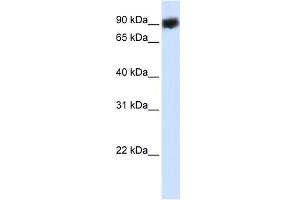 WB Suggested Anti-HSP90B1 Antibody Titration:  0. (GRP94 anticorps  (C-Term))