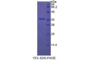 SDS-PAGE analysis of Human Semaphorin 7A Protein.