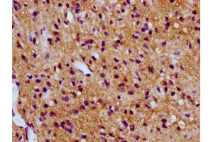 IHC image of ABIN7171107 diluted at 1:300 and staining in paraffin-embedded human glioma performed on a Leica BondTM system. (SV2C anticorps  (AA 459-524))