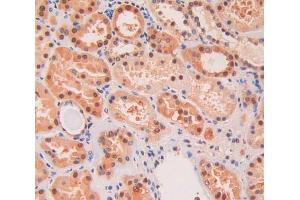 IHC-P analysis of kidney tissue, with DAB staining. (KIF5A anticorps  (AA 473-605))
