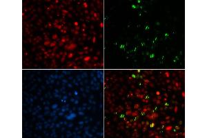 Immunofluorescence (IF) image for anti-Centrin, EF-Hand Protein, 2 (CETN2) antibody (ABIN1876585) (CETN2 anticorps)