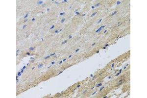 Immunohistochemistry of paraffin-embedded Rat heart using FECH Polyclonal Antibody at dilution of 1:100 (40x lens). (FECH anticorps)