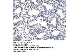 Rabbit Anti-CARS Antibody  Paraffin Embedded Tissue: Human Lung Cellular Data: Alveolar cells Antibody Concentration: 4.
