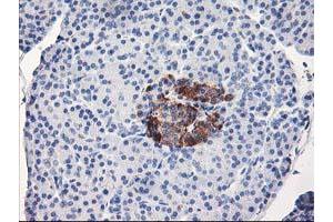 Immunohistochemical staining of paraffin-embedded Human pancreas tissue using anti-ACSS2 mouse monoclonal antibody. (ACSS2 anticorps)