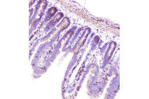 IHC analysis of RASAL1 using anti-RASAL1 antibody (ABIN6719367). (RASAL1 anticorps  (AA 721-798))