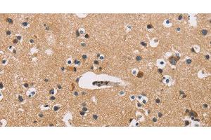 Immunohistochemistry of paraffin-embedded Human brain tissue using ATP2C1 Polyclonal Antibody at dilution 1:50