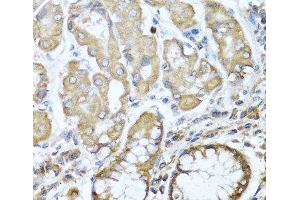 Immunohistochemistry of paraffin-embedded Human stomach using NRG4 Polyclonal Antibody at dilution of 1:100 (40x lens). (Neuregulin 4 anticorps)
