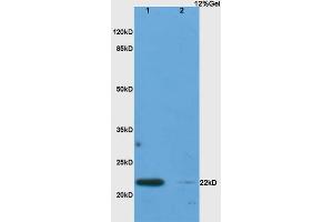 Lane 1: rat lung lysates Lane 2: rat pancreas lysates probed with Anti IL-17C Polyclonal Antibody, Unconjugated (ABIN747983) at 1:200 in 4 °C.
