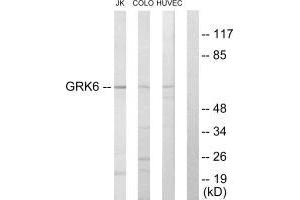 Western blot analysis of extracts from Jurkat cells, COLO205 cells and HUVEC cells, using GRK6 antibody. (GRK6 anticorps  (N-Term))