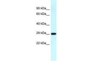 Image no. 1 for anti-Ribosomal Protein S4, Y-Linked 1 (RPS4Y1) (C-Term) antibody (ABIN6747705) (RPS4Y1 anticorps  (C-Term))