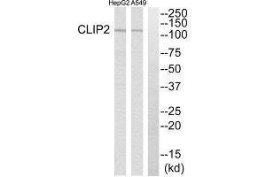 Western Blotting (WB) image for anti-CAP-GLY Domain Containing Linker Protein 2 (CLIP2) (C-Term) antibody (ABIN1850986) (CLIP2 anticorps  (C-Term))