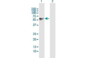 Western Blot analysis of ARSA expression in transfected 293T cell line by ARSA MaxPab polyclonal antibody. (Arylsulfatase A anticorps  (AA 1-507))