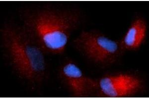Immunofluorescence (IF) image for anti-Complexin 1 (CPLX1) (AA 1-134) antibody (PE) (ABIN5565320)
