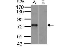 WB Image SYK antibody [N2C2], Internal detects SYK protein by western blot analysis.