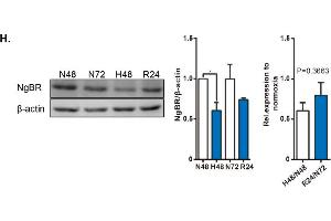 NgBR expression is downregulated in the pulmonary artery of HPH rat model and in vascular smooth muscle cells (VSMCs) exposed to hypoxia.