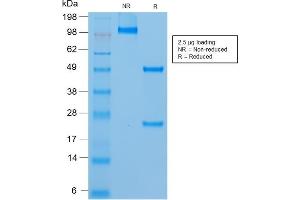 SDS-PAGE Analysis of Purified MUC18 Mouse Recombinant Monoclonal Antibody (rMUC18/1130). (Recombinant MCAM anticorps)