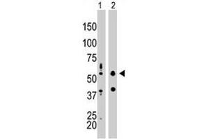 The EIF2AK2 polyclonal antibody  is used in Western blot to detect EIF2AK2 in mouse liver tissue lysate (Lane 1) and HepG2 cell lysate (Lane 2) . (EIF2AK2 anticorps  (N-Term))