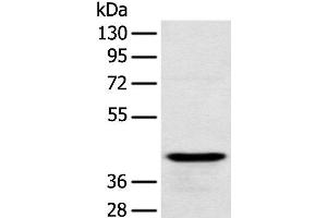 Western blot analysis of Human testis tissue using RSPH1 Polyclonal Antibody at dilution of 1:250