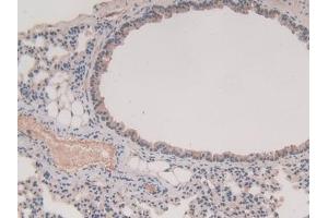 Detection of GSTM1 in Mouse Lung Tissue using Polyclonal Antibody to Glutathione S Transferase Mu 1 (GSTM1)