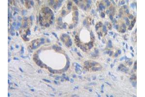 Image no. 1 for anti-Interleukin 2 (IL2) antibody (ABIN181648)