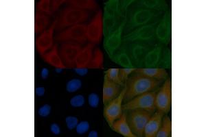 TFG Mouse Monoclonal Antibody staining Hela cells by IF/ICC. (TFG anticorps)