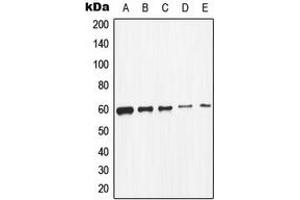 Western blot analysis of c-SRC expression in K562 (A), HeLa (B), MCF7 (C), HepG2 (D), mouse primary astrocytes (E) whole cell lysates. (Src anticorps  (C-Term))