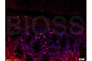 Formalin-fixed and paraffin embedded mouse kidney tissue labeled with Rabbit Anti-L-Selectin/CD62L Polyclonal Antibody (ABIN736716), Unconjugated 1:200 followed by conjugation to the secondary antibody and DAB staining