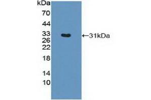 Western blot analysis of recombinant Mouse MHCDRb1. (HLA-DRB1 anticorps  (AA 27-264))