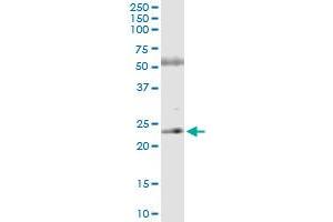 Immunoprecipitation of ASPH transfected lysate using anti-ASPH MaxPab rabbit polyclonal antibody and Protein A Magnetic Bead , and immunoblotted with ASPH purified MaxPab mouse polyclonal antibody (B02P) .