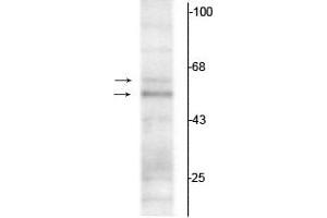 Western blot of rat hippocampal lysate showing specific immunolabeling of the ~50 kDa TR-α1 and the ~58 kDa TR-α2 protein. (THRA anticorps  (N-Term))