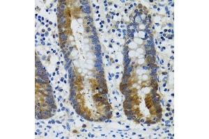 Immunohistochemistry of paraffin-embedded human vermiform appendix using HSPH1 antibody. (HSPH1 anticorps  (AA 659-858))