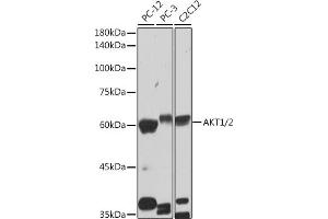Western blot analysis of extracts of various cell lines, using /2 antibody (ABIN1679270, ABIN1679271, ABIN7101491 and ABIN7101492) at 1:1000 dilution. (AKT1/2 anticorps)