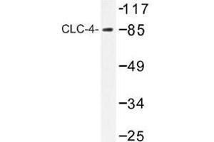 Image no. 1 for anti-Chloride Channel 4 (CLCN4) antibody (ABIN317826) (CLCN4 anticorps)