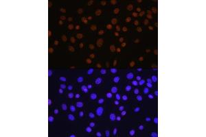 Immunofluorescence analysis of NIH/3T3 cells using HD antibody (ABIN7267707) at dilution of 1:100. (HDAC1 anticorps)