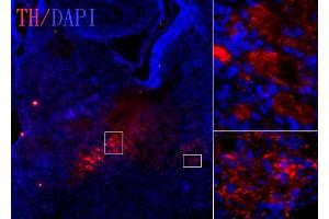 anti-Tyrosine Hydroxylase (TH) antibody