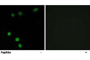 Immunofluorescence analysis of MCF-7 cells, using TP53INP2 polyclonal antibody . (TP53INP2 anticorps)