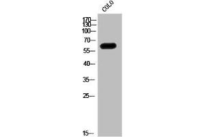 Western Blot analysis of CoLo cells using ALS Polyclonal Antibody