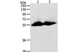 Western Blot analysis of Human colon and ovarian cancer tissue using MMP11 Polyclonal Antibody at dilution of 1:600 (MMP11 anticorps)