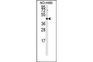 Image no. 1 for anti-Required For Meiotic Nuclear Division 5 Homolog B (RMND5B) (C-Term) antibody (ABIN357964) (RMND5B anticorps  (C-Term))