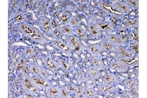 IHC analysis of IGF1 Receptor using anti-IGF1 Receptor antibody .