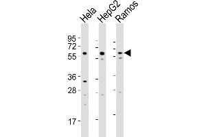 Western Blot at 1:2000 dilution Lane 1: Hela whole cell lysates Lane 2: HepG2 whole cell lysates Lane 3: Ramos whole cell lysates Lysates/proteins at 20 ug per lane.