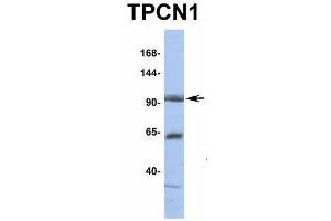 Host:  Rabbit  Target Name:  TPCN1  Sample Type:  HT1080  Antibody Dilution:  1. (TPCN1 anticorps  (N-Term))