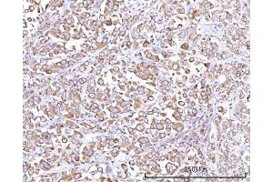 IHC analysis of RPN1 using anti-RPN1 antibody (ABIN7600447). (RPN1 anticorps  (AA 196-495))