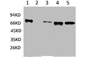 Western blot analysis of 1) Hela, 2) Jurkat, 3) Mouse Brain, 4) Mouse Kidney, 5) Rat Brain using ZBTB45 Polyclonal Antibody. (ZBTB45 anticorps)