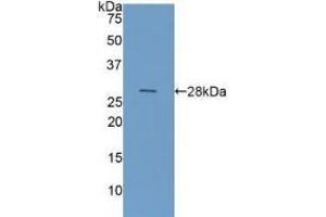 WB of Protein Standard: different control antibodies against Highly purified E.